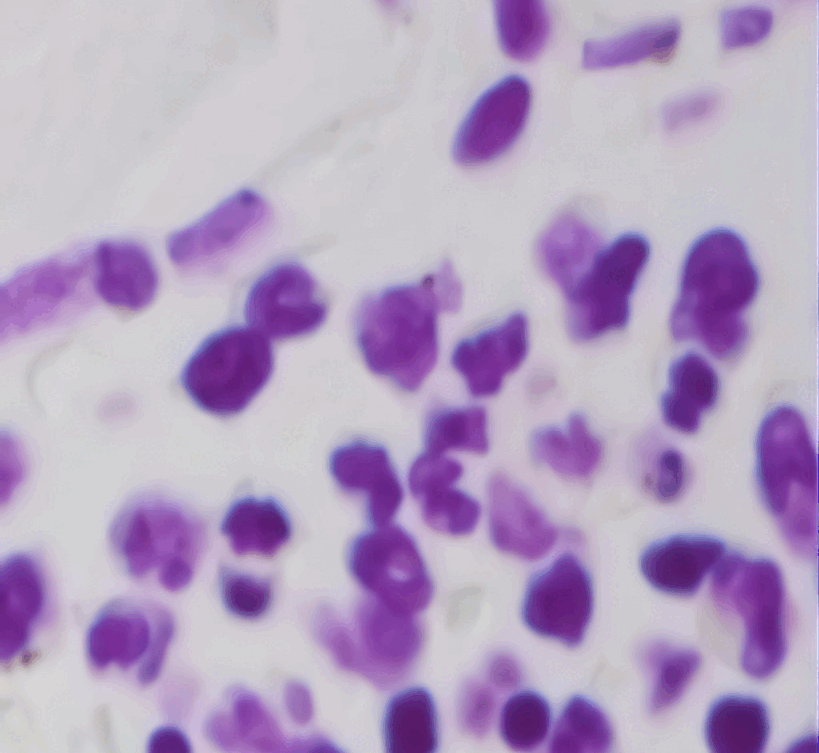 Modelo de segmentación de imágenes identificando células en una muestra microscópica